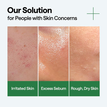 Teatree Calming Hydra Serum