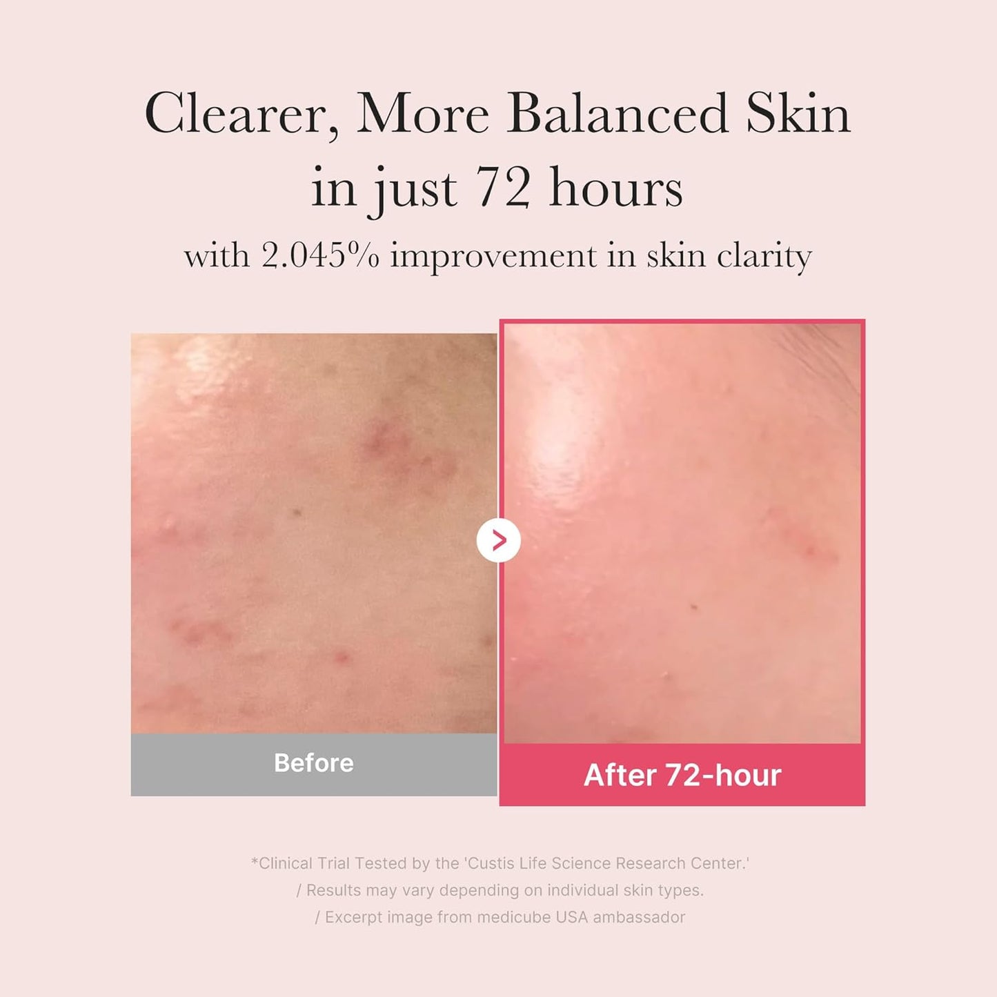 TXA+Niacinamide 15 Serum
