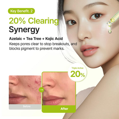 Azelaic Acid 10 Kojic Tea Tree Serum
