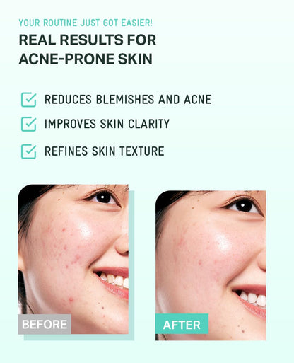 Tea Tree Cica Soothing Cream