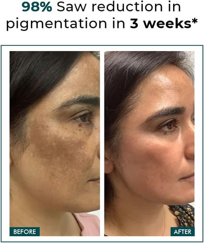 Trubiom Pigmentation Corrector Cream