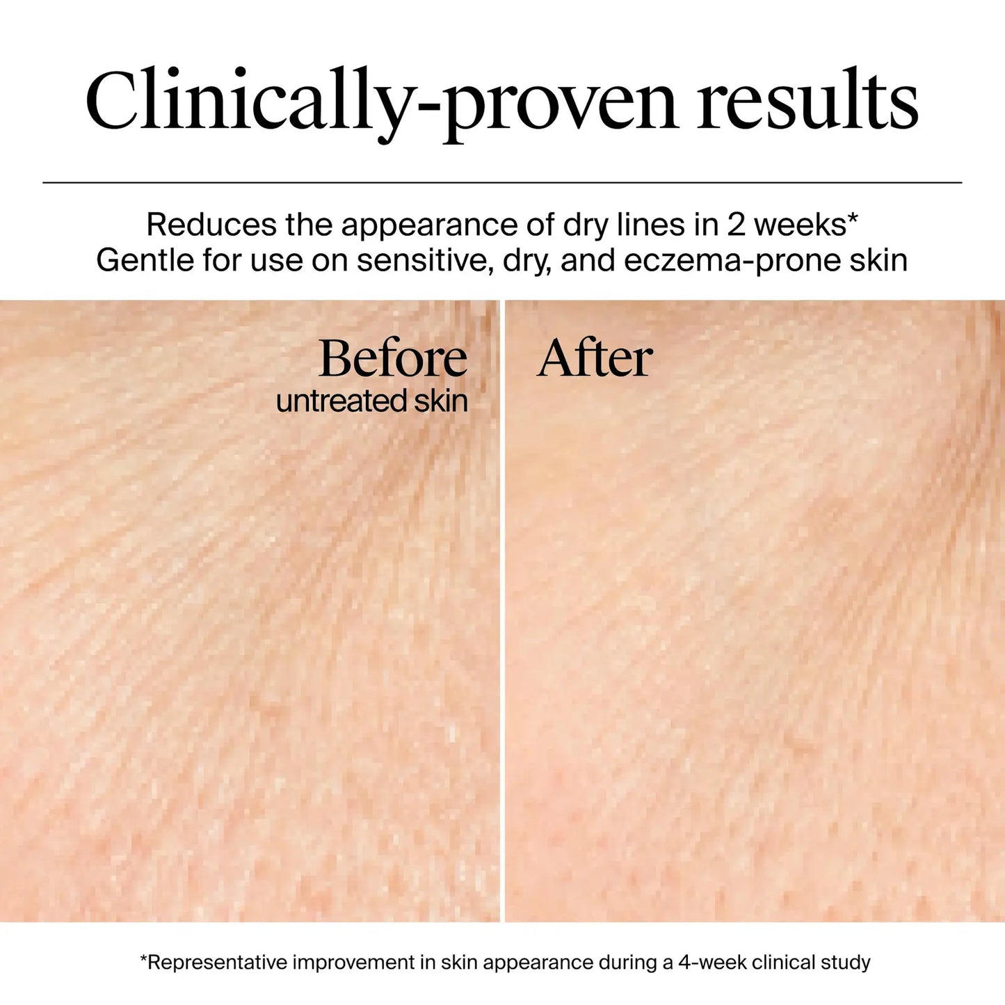 Hydro Boost Gel-Crème