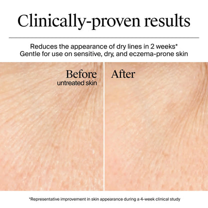 Hydro Boost Gel-Crème