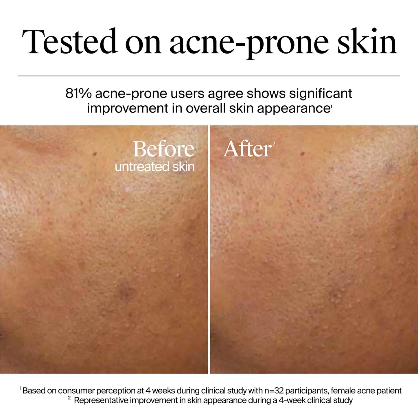 Hydro Boost Gel-Crème