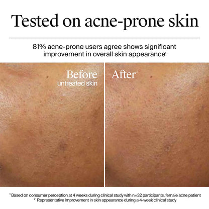 Hydro Boost Gel-Crème