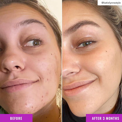 Niacinamide Brightening Toner