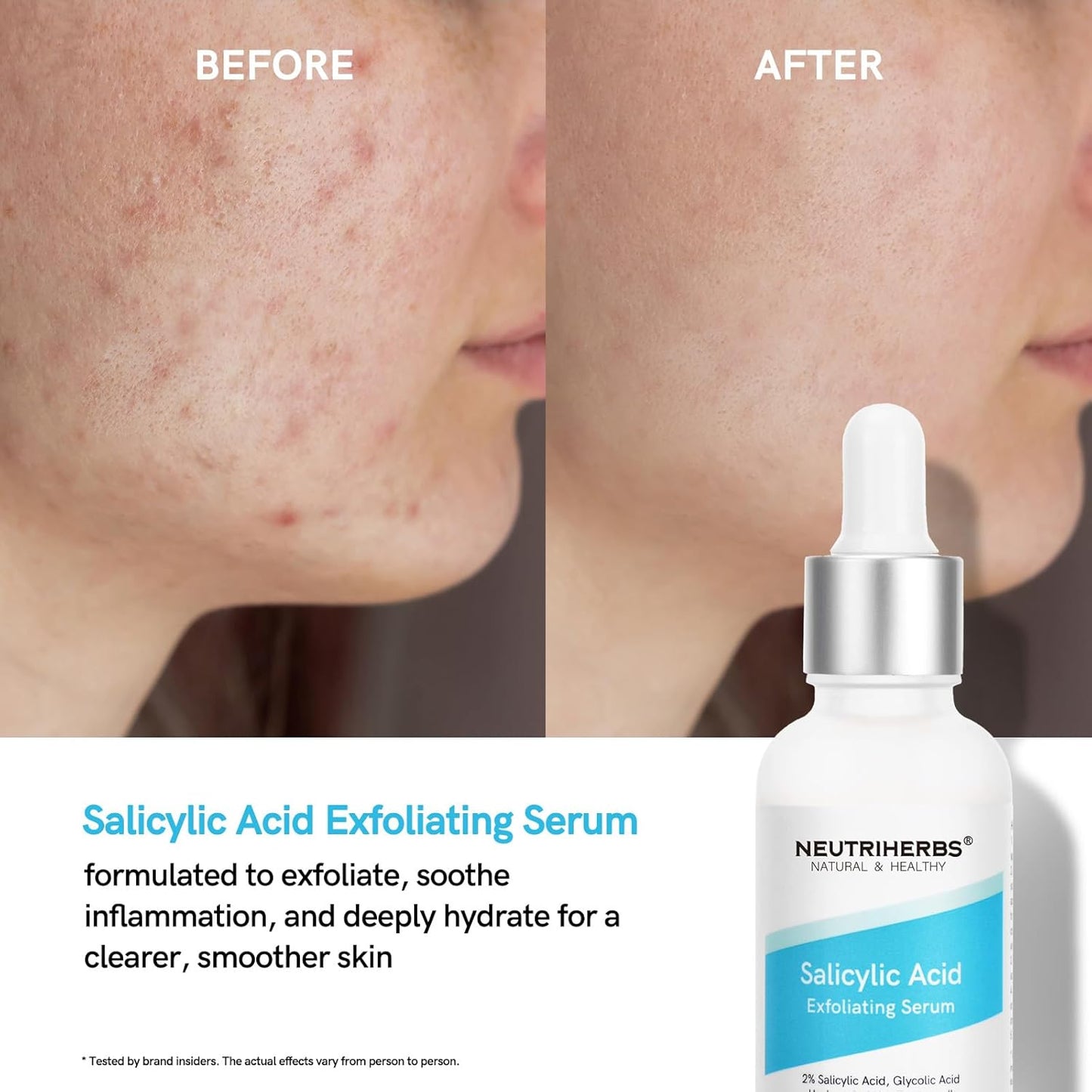 Salicylic Acid Exfoliating Serum