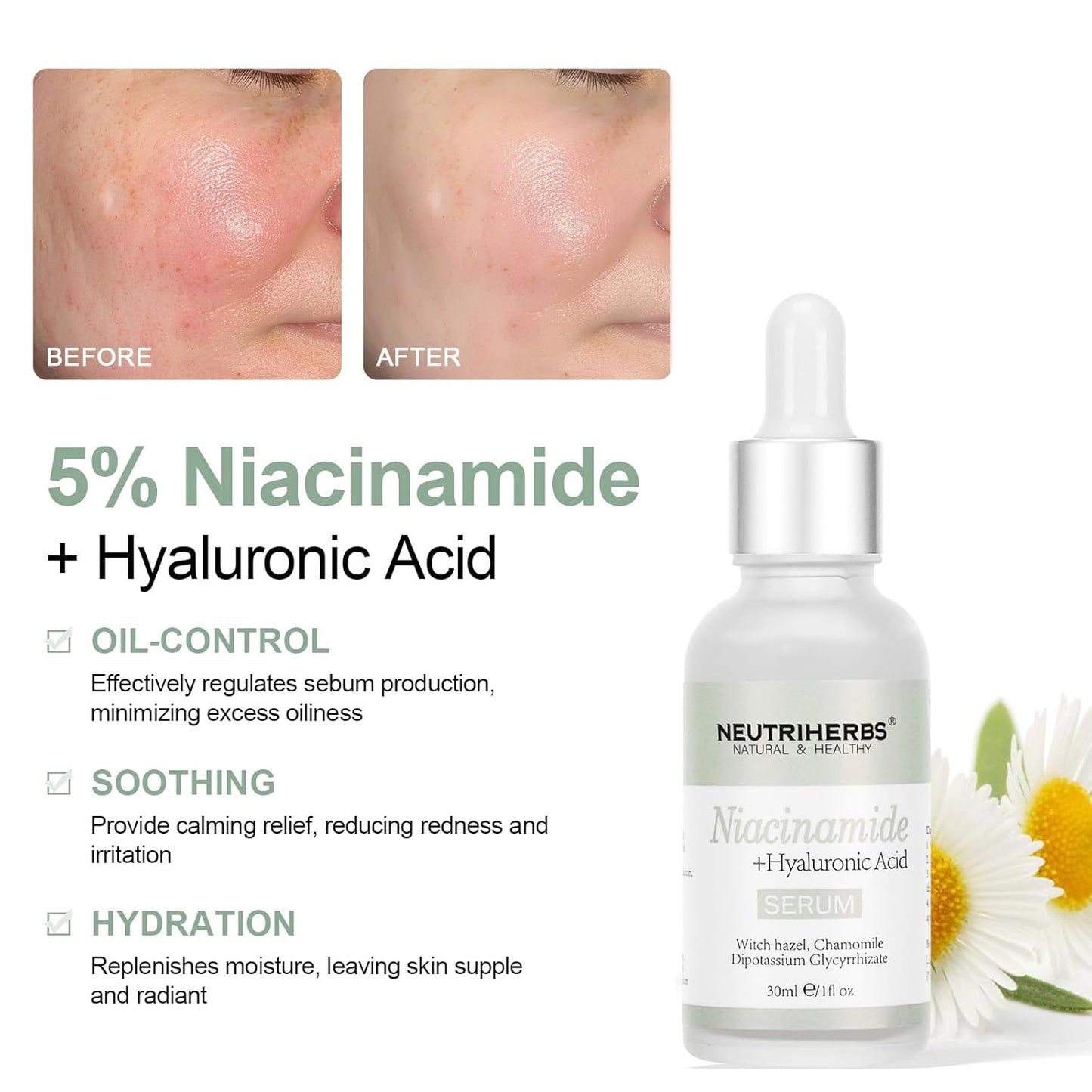 Niacinamide + Hyaluronic Acid serum
