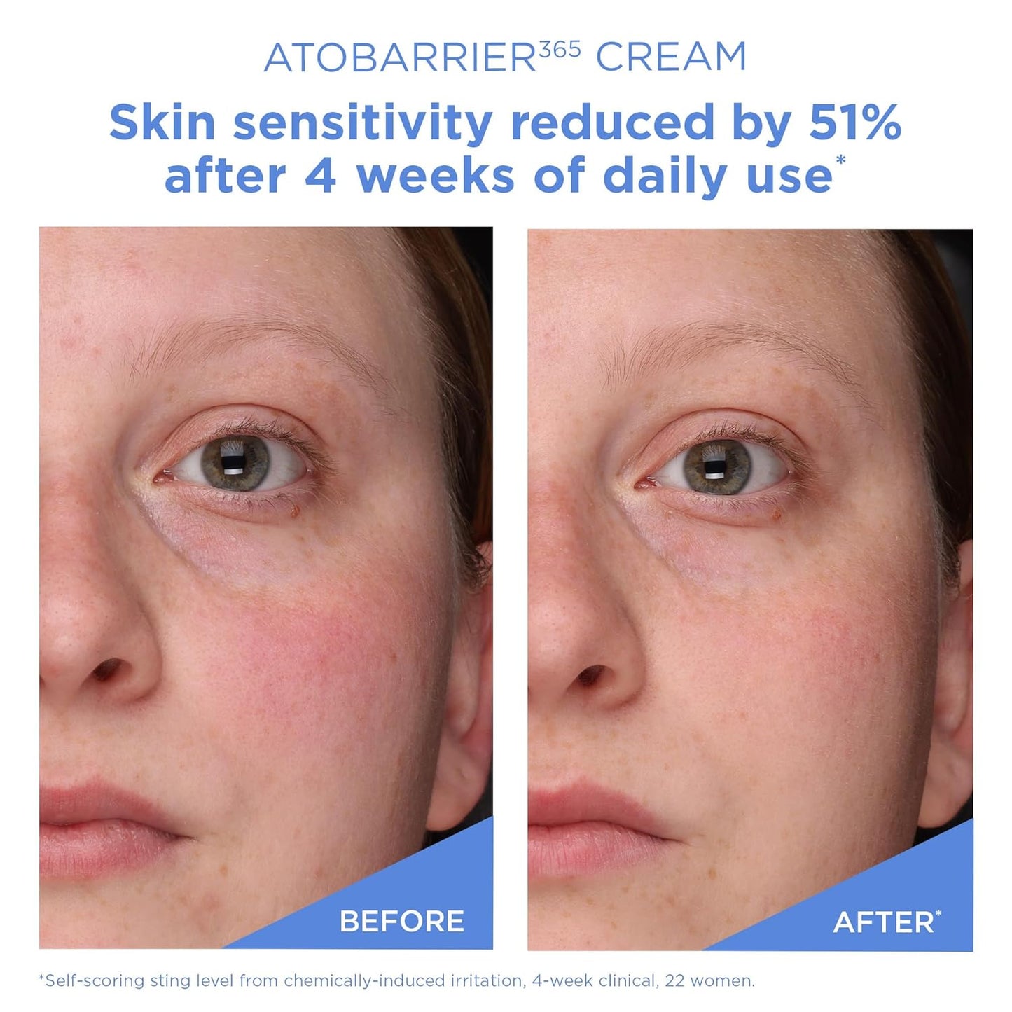 Atobarrier 365 Cream