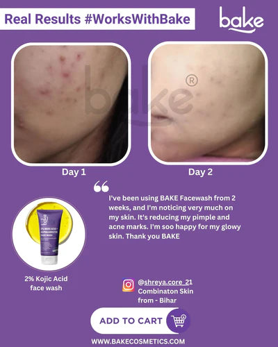 Kojic Acid + Alpha Arbutin Face wash
