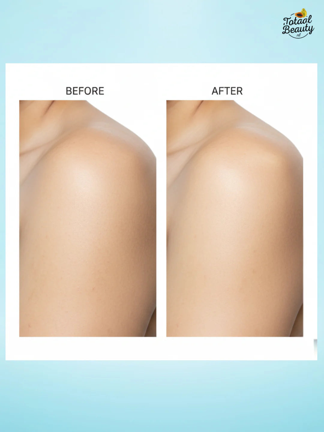 Kojic Acid And Tranexamic Whitening Bar