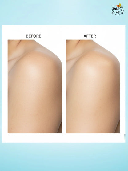 Kojic Acid And Tranexamic Whitening Bar