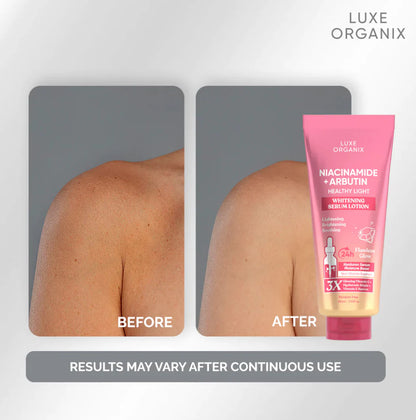 Niacinamide + Arbutin Healthy Light Whitening Serum Lotion