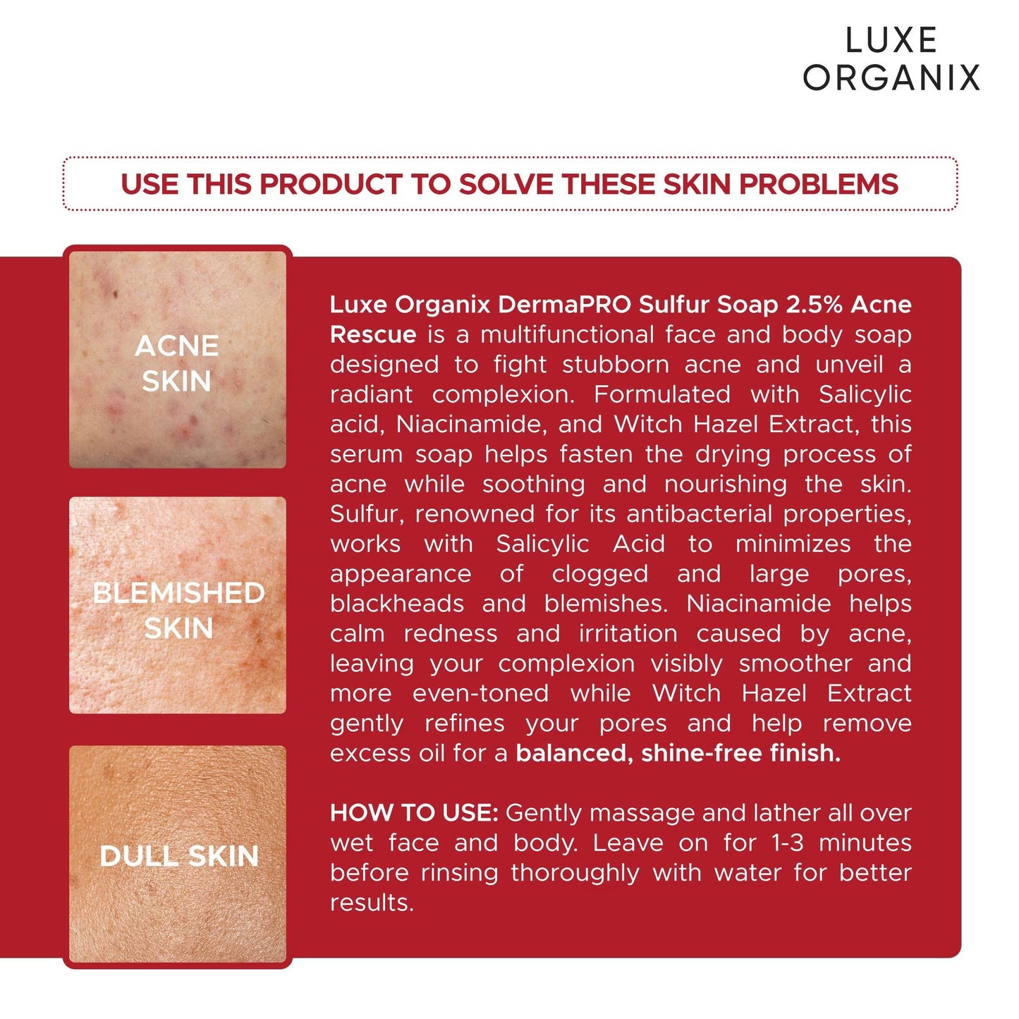 DermaPRO Sulfur Soap 2.5% Acne Rescue