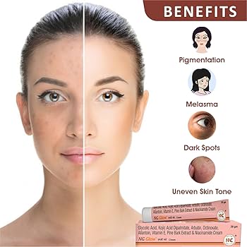 NG Glow Cream