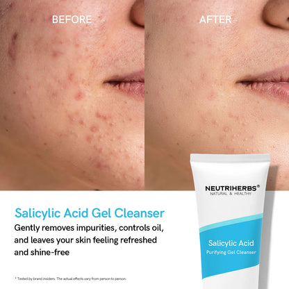 Salicylic Acid Purifying Gel Cleanser