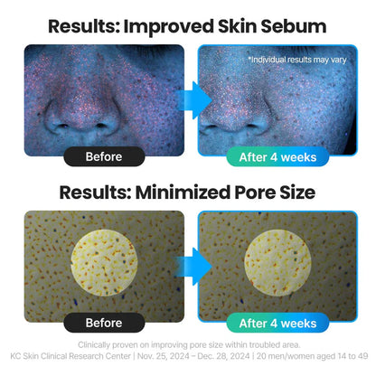 R.E.D Blemish Clear Hyal Cica Soothing Serum