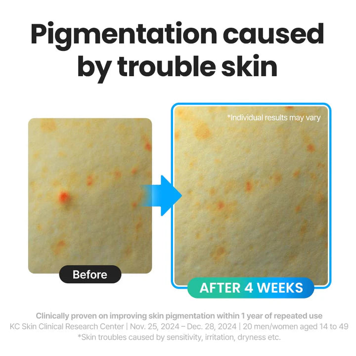 R.E.D Blemish Clear Hyal Cica Soothing Serum