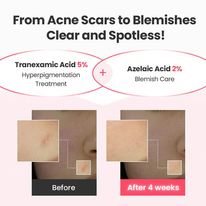 R.E.D Blemish Tranexamic Acid 21.5 Repair Serum