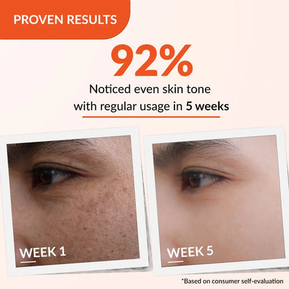 Skarfix-TX Cream | Effective treatment for melasma and dark spots